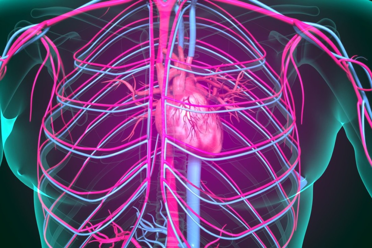 Angioplastia Coronária