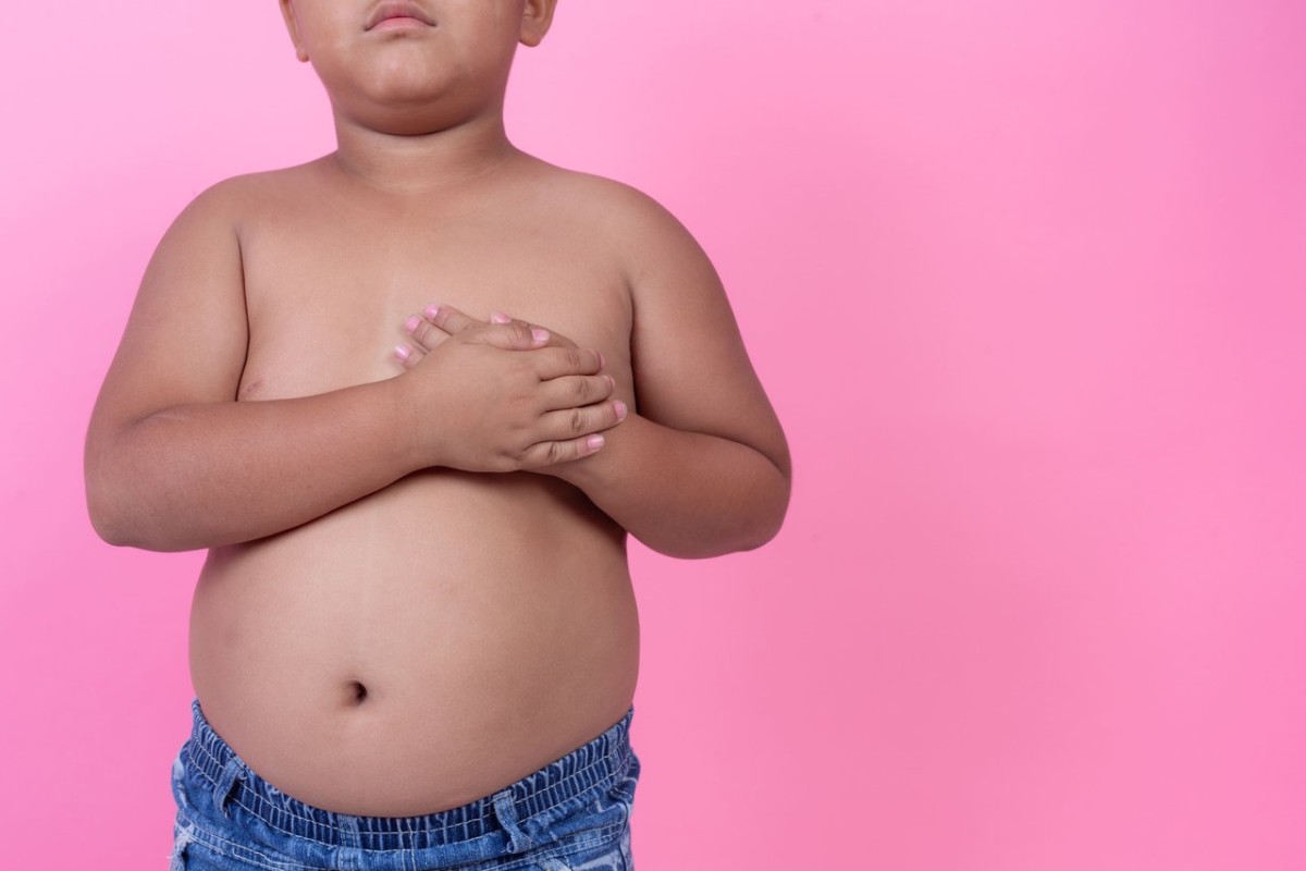 Dia Nacional de Prevenção à Obesidade