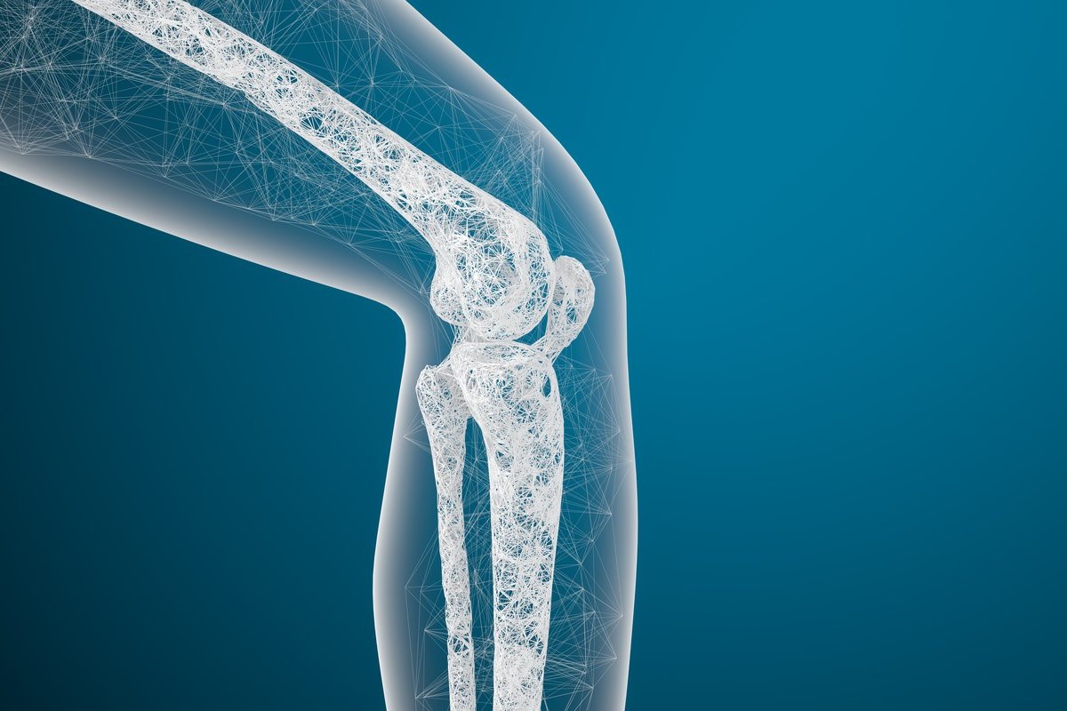 Osteoporose - Causas, sintomas e tratamento