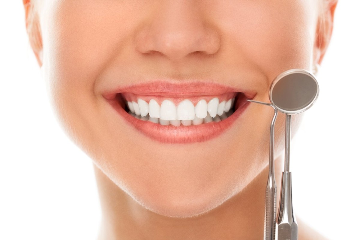Lentes de Contato para os dentes