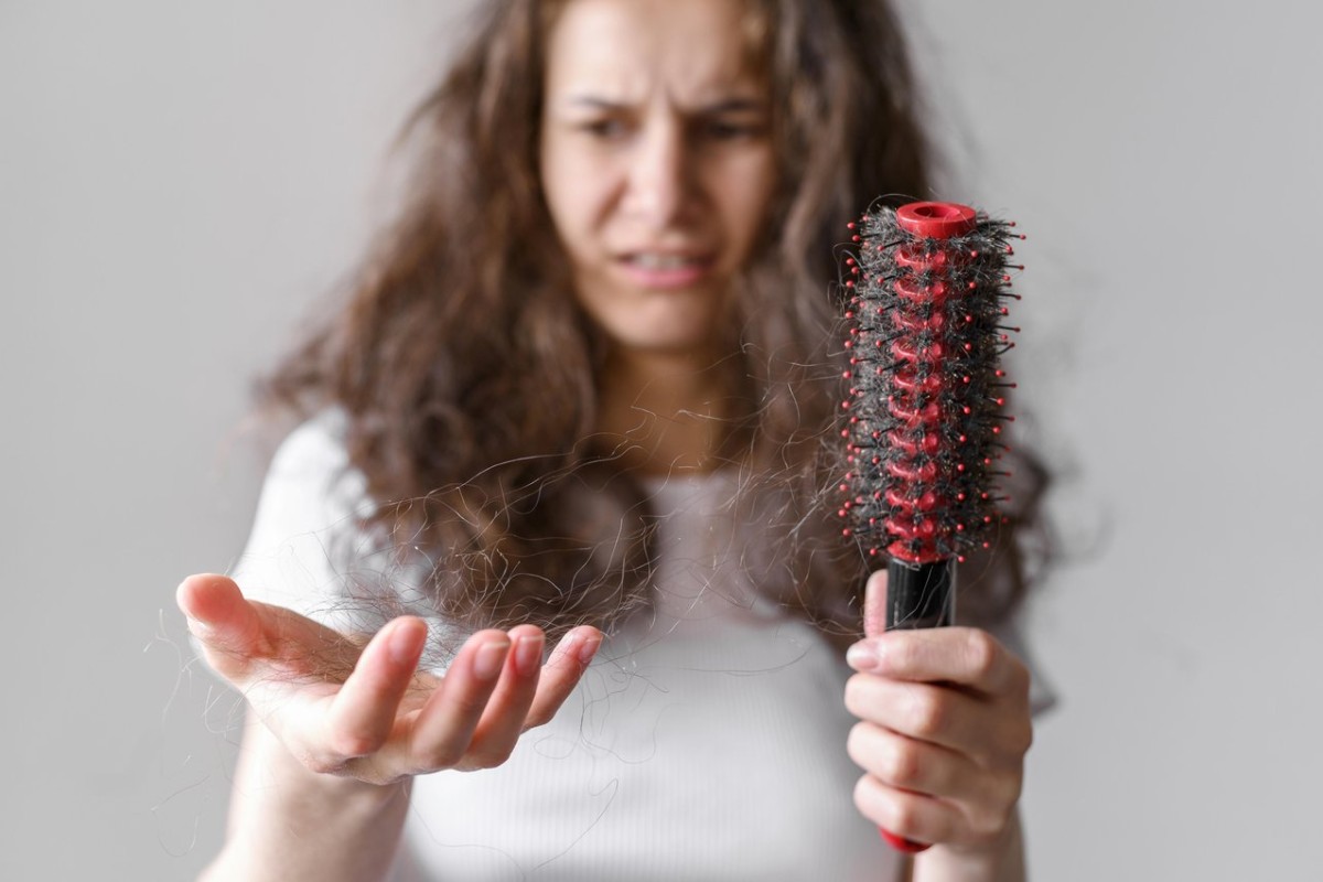 Queda de cabelo excessiva?