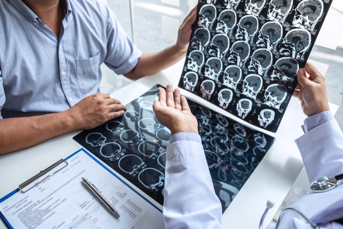 Doença de Parkinson atinge 200 mil brasileiros: saiba os sintomas e como identificar precocemente