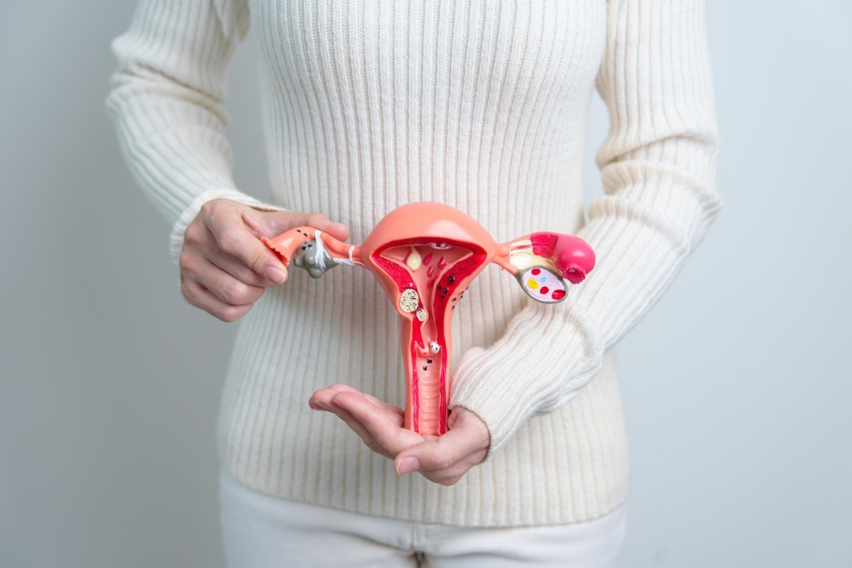 Adenomiose afeta até 61% das mulheres e pode ser tratada sem cirurgia