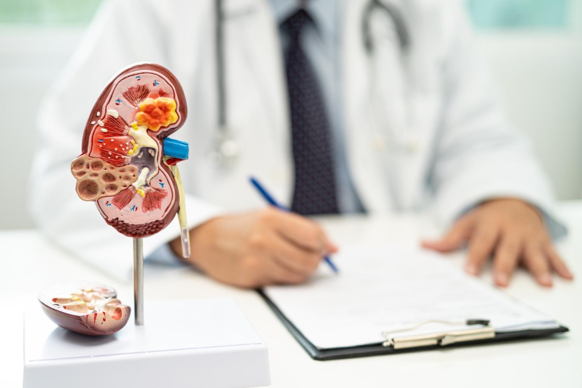 Tabagismo e obesidade aumentam risco de câncer renal, que afeta 11 mil brasileiros anualmente