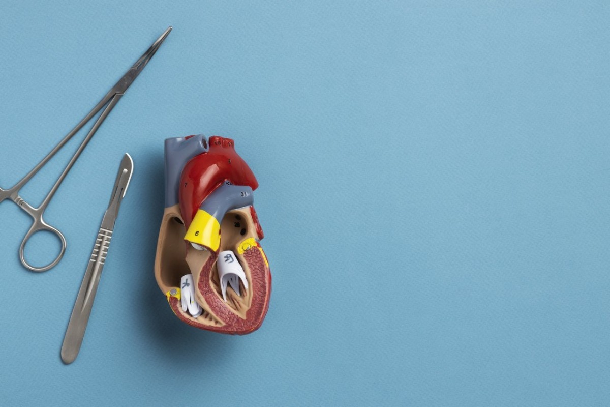 Cirurgia no coração: o que você precisa saber?