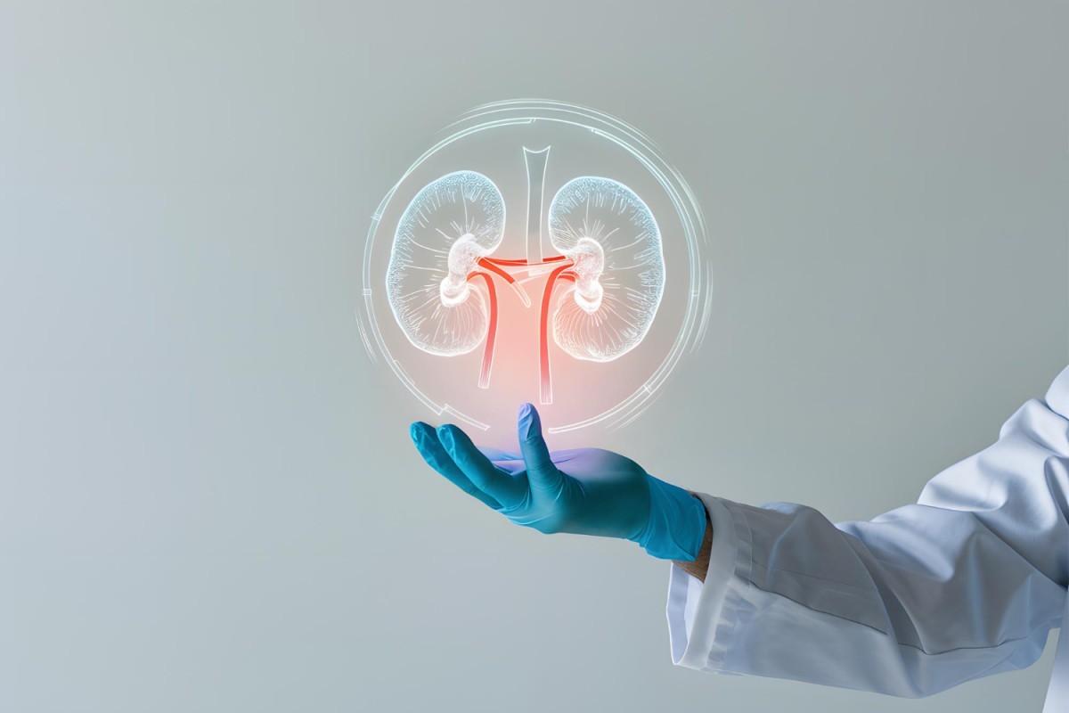 Pedra nos Rins: Hidratação é Essencial para Prevenir Cálculo Renal