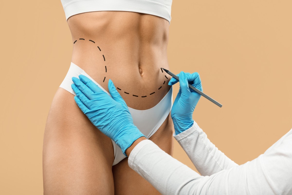 6 cuidados essenciais antes de realizar uma cirurgia plástica