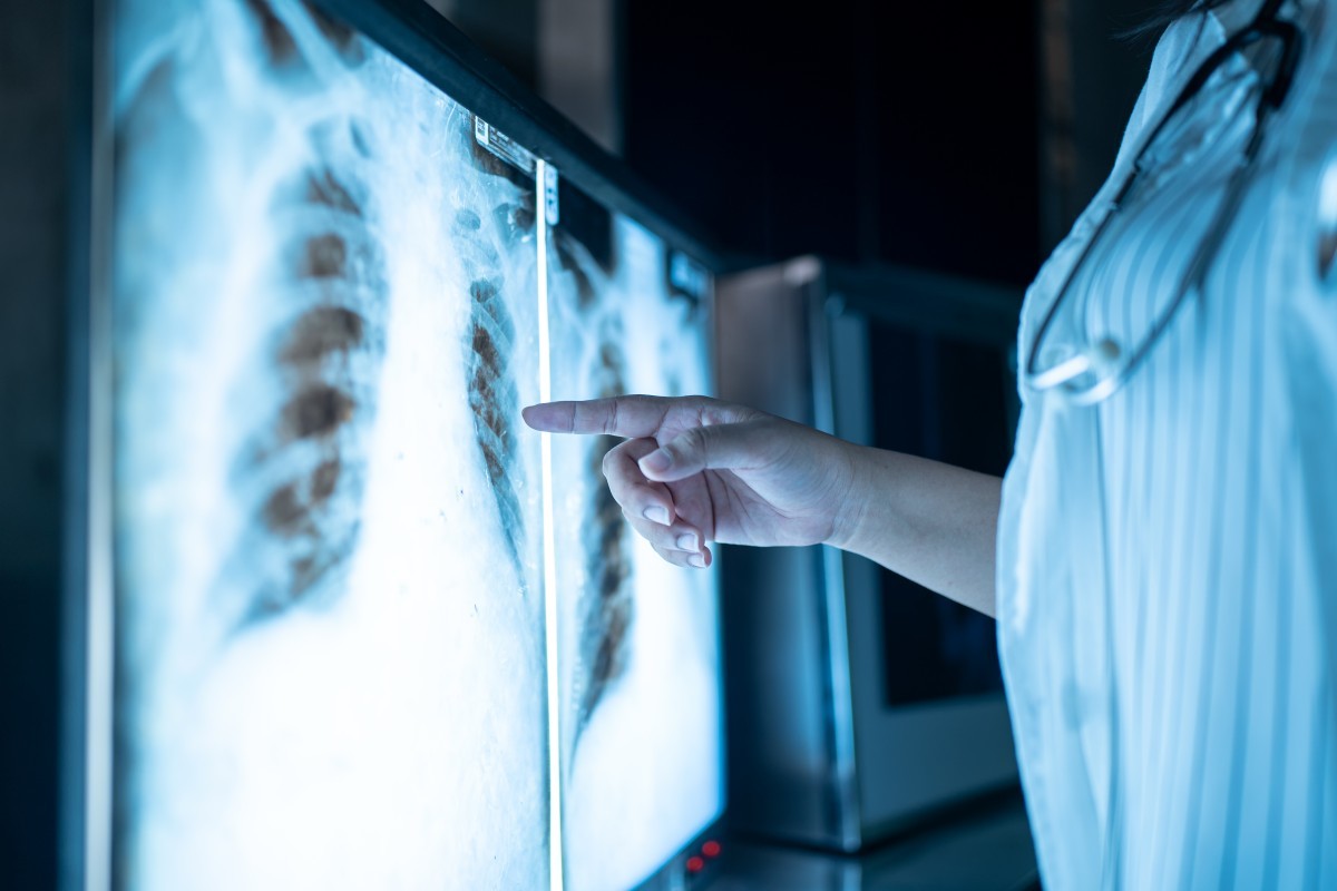 Radiologia Intervencionista ganha 16 de janeiro como data mundial