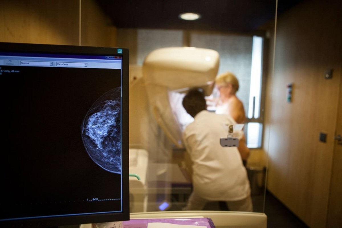 Mamografia: Desvendando Mitos e Verdades Essenciais para a Saúde