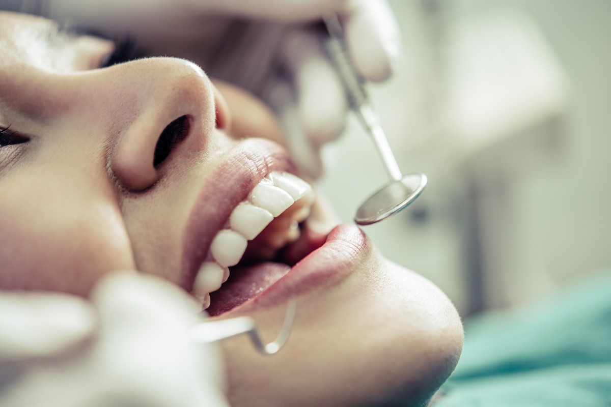 Bleachorexia: Quando o Clareamento Dental se Transforma em Comportamento Compulsivo