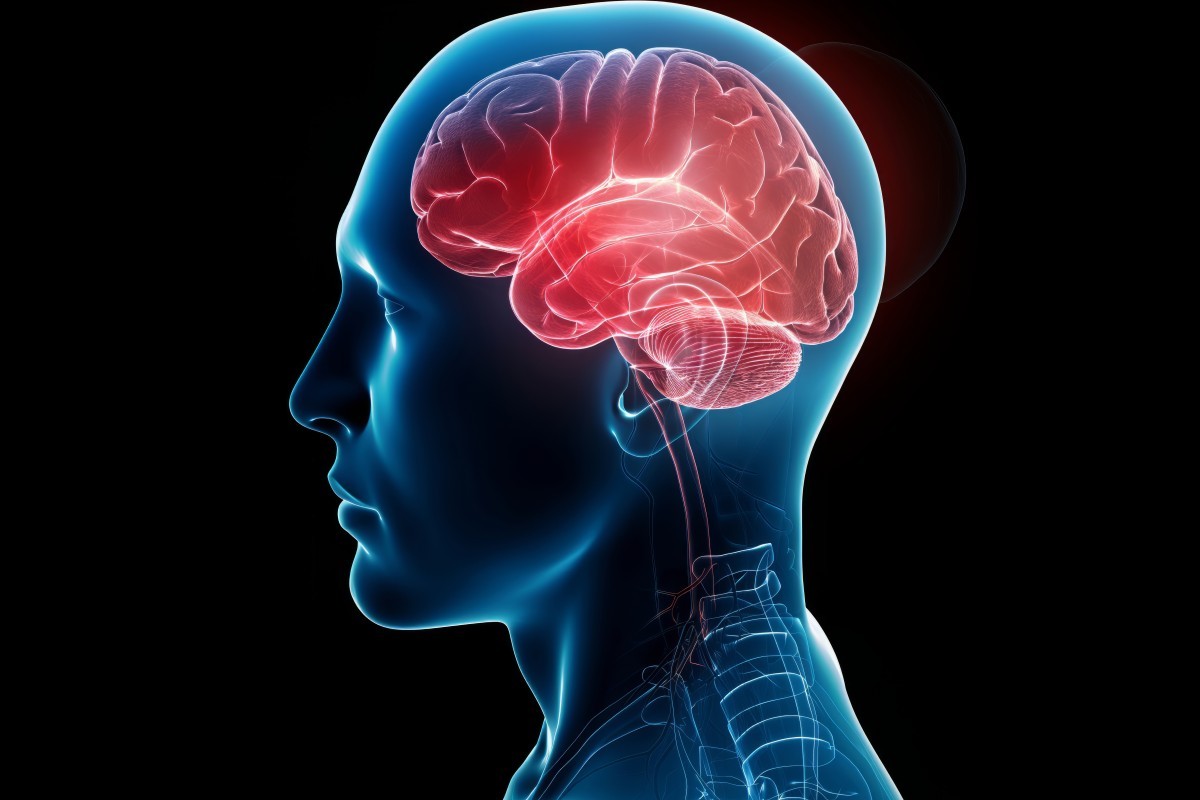 Epilepsia: Tratamento Adequado Pode Eliminar Crises em 70% dos Pacientes
