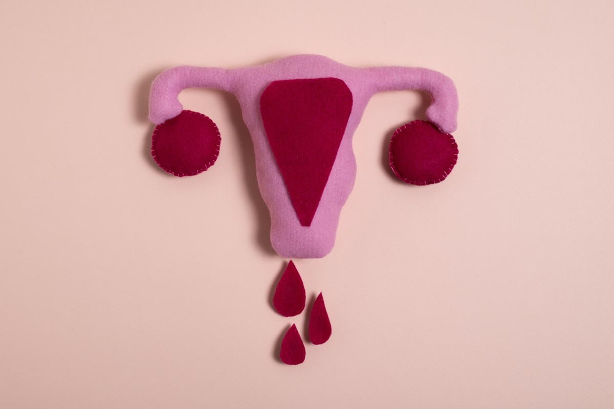 Menstruação na Adolescência: Como Tabus e Falta de Absorventes Impactam a Educação das Meninas