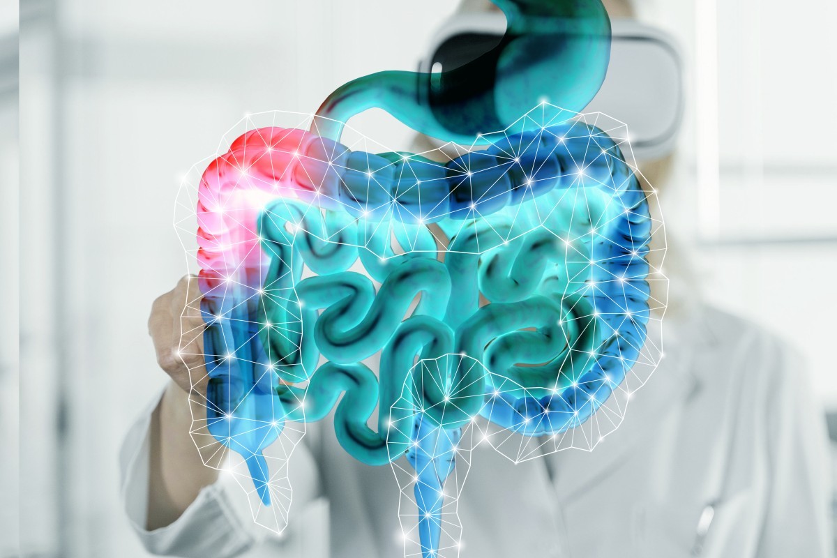 Obesidade e Saúde Intestinal: Estudos Revelam a Relação com o Risco de Alzheimer
