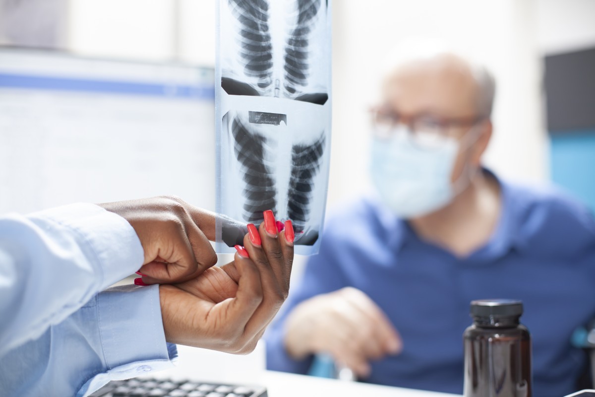 Implantes Ortopédicos e Detectores de Metais: O Que Você Precisa Saber Antes de Viajar