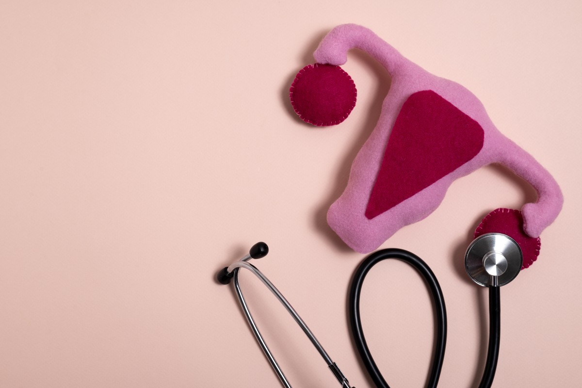 Endometriose Pode Elevar o Risco de Infarto e AVC, Aponta Estudo