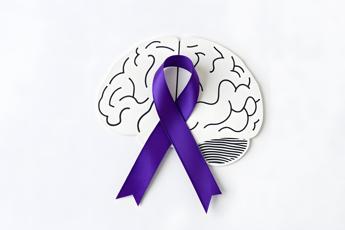 Epilepsia: 10 Mitos e Verdades Sobre a Doença que Afeta Milhões no Mundo