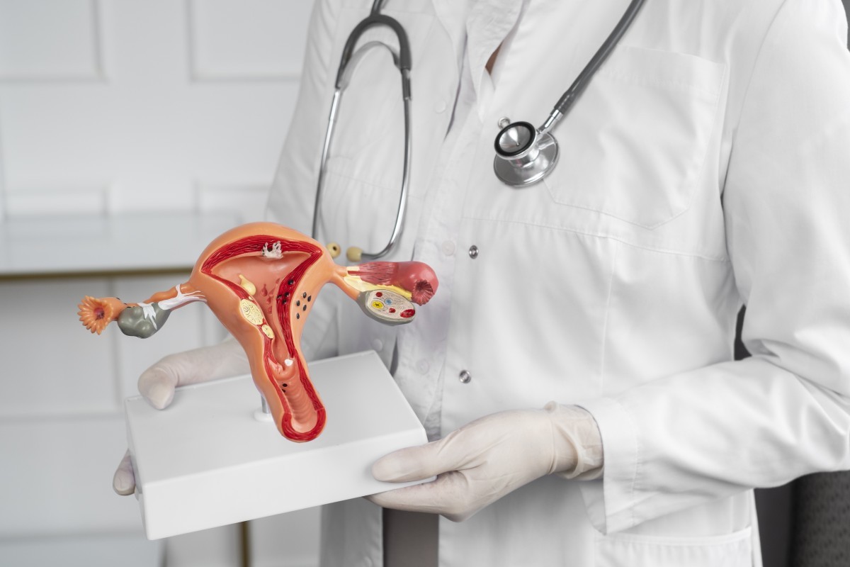 Embolização Uterina: Alternativa Eficaz no Tratamento de Miomas e Preservação do Útero