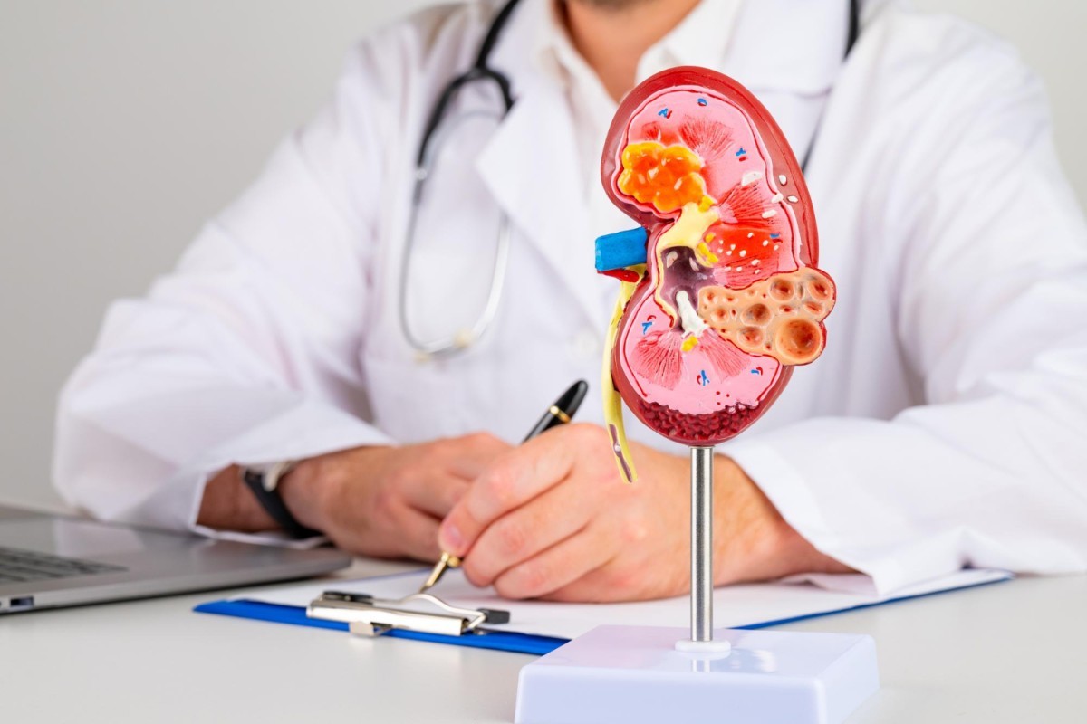 Dia Mundial do Rim: O Alerta Silencioso da Nefrite Lúpica na Saúde Renal