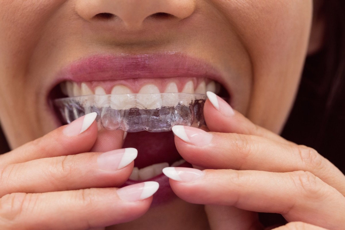 Bruxismo: Por Que Ranger os Dentes se Tornou o Mal do Século?