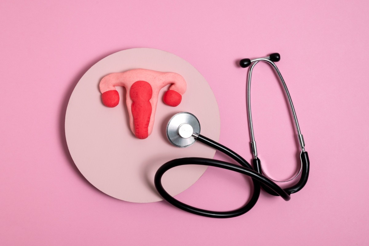 Endometriose: Alimentação Anti-inflamatória Alivia Dores e Melhora a Qualidade de Vida