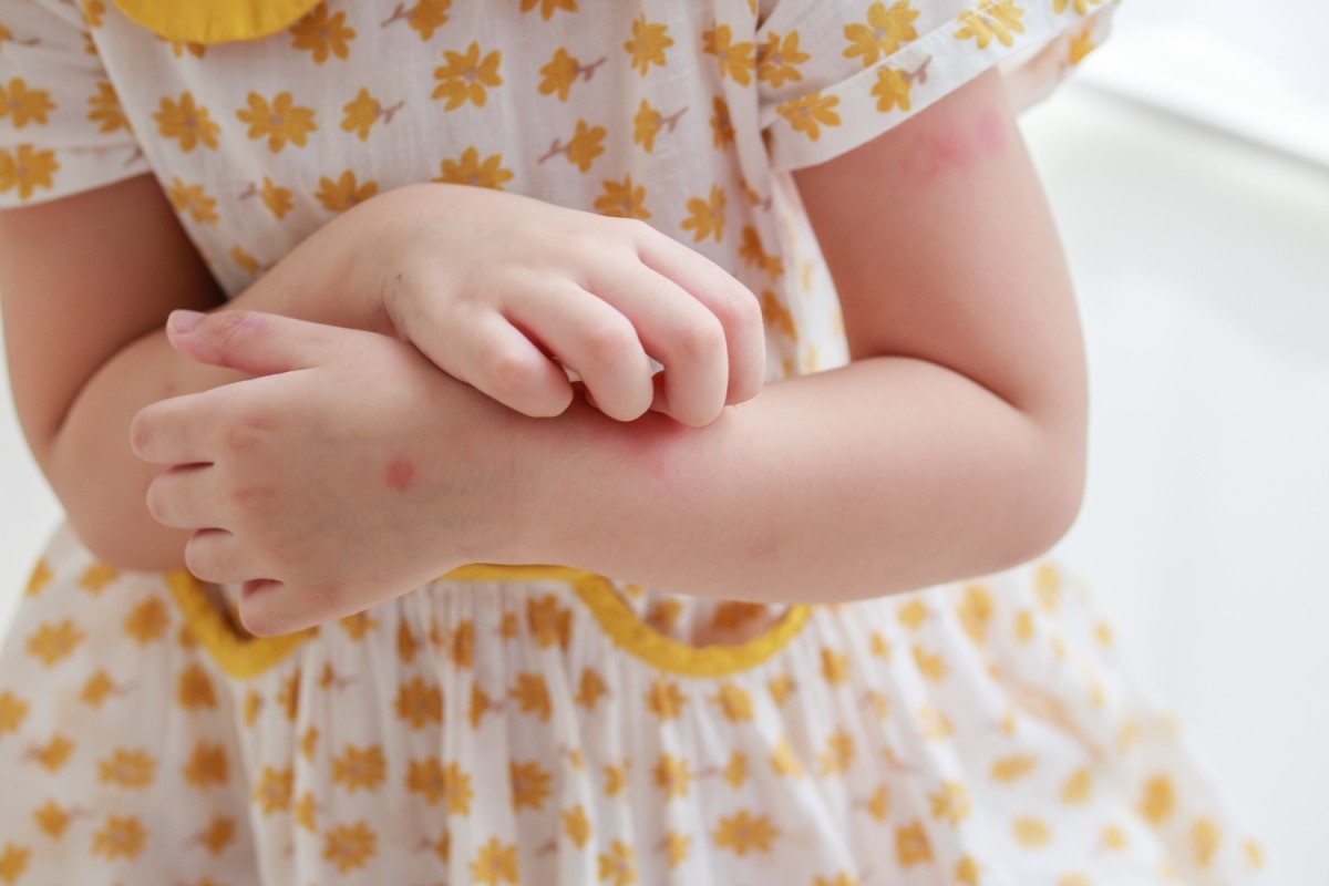 PFIC3: Doença Hepática Ultrarara Afeta Crescimento e Desenvolvimento Infantil