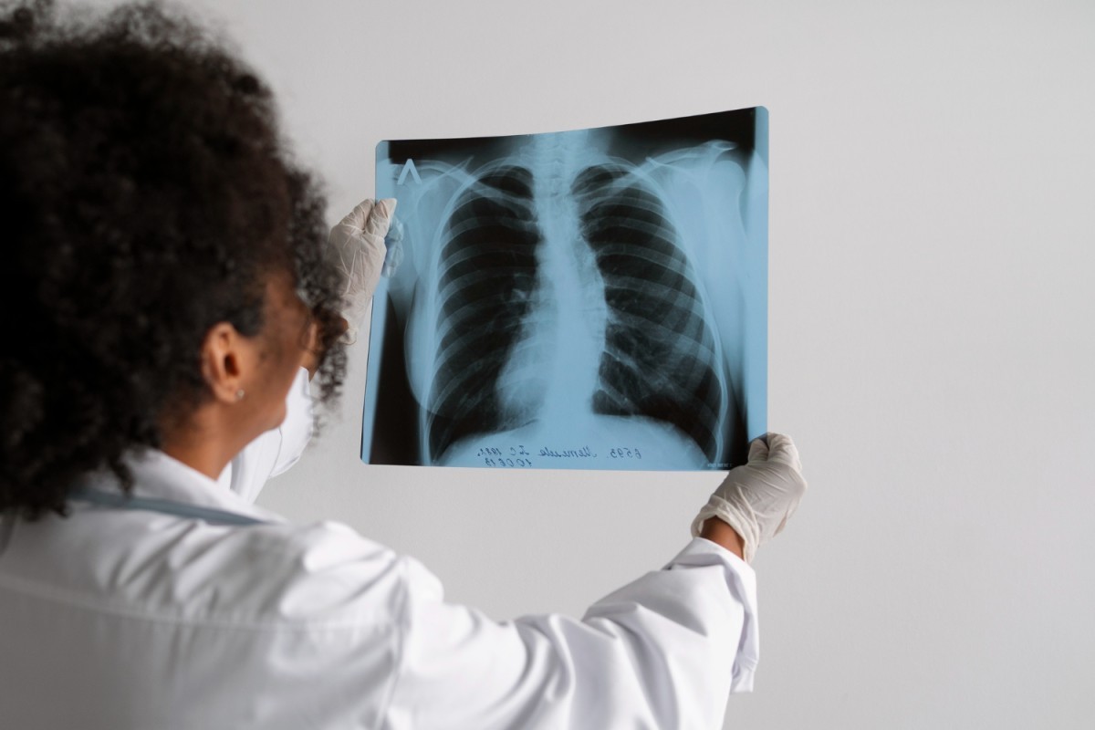 Vírus Sincicial Respiratório: Casos Aumentam no Outono e Exigem Atenção